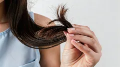 栄養士が解説：髪を取り返しのつかないほど傷める食習慣4つ